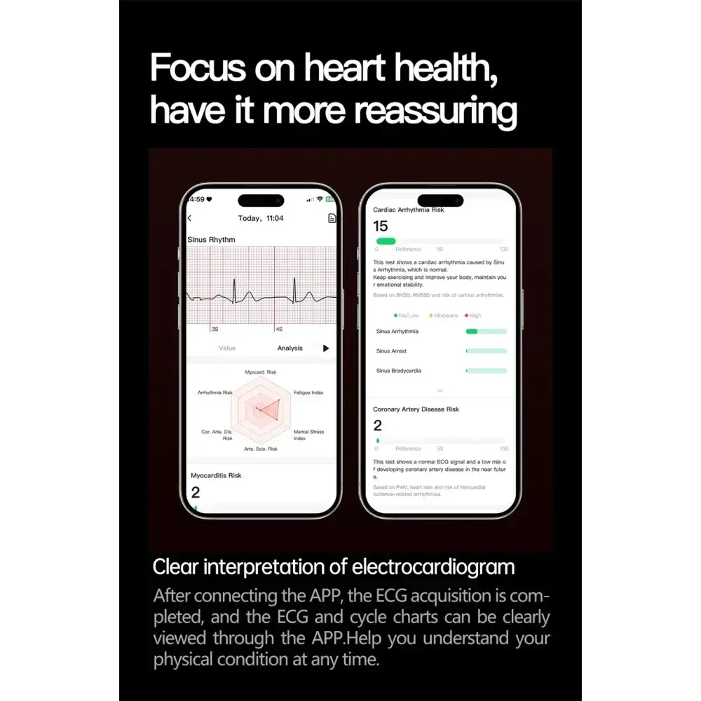 2025 nouveau pour XIAOMI santé Trackr acide uricique lipides sanguins montre intelligente pression artérielle ECG + PPG