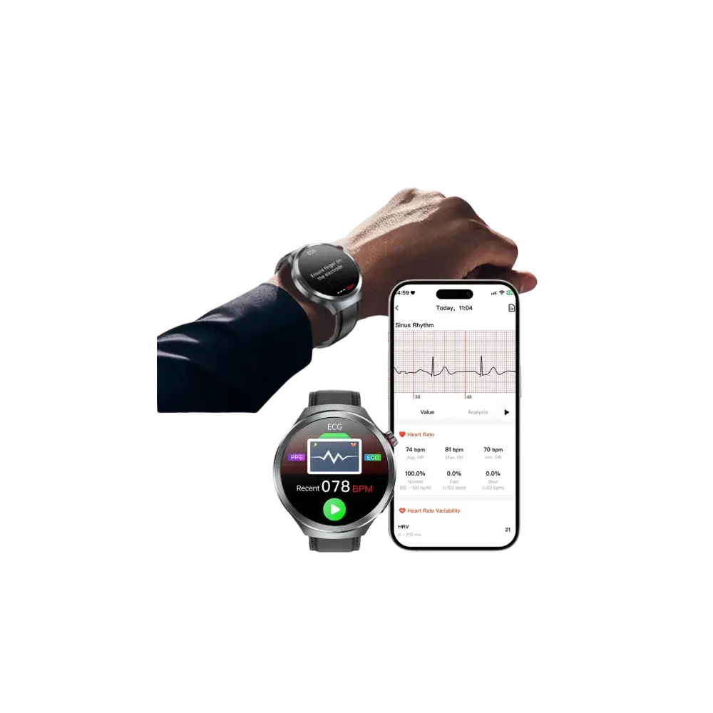 2025 nouveau pour XIAOMI santé Trackr acide uricique lipides sanguins montre intelligente pression artérielle ECG + PPG