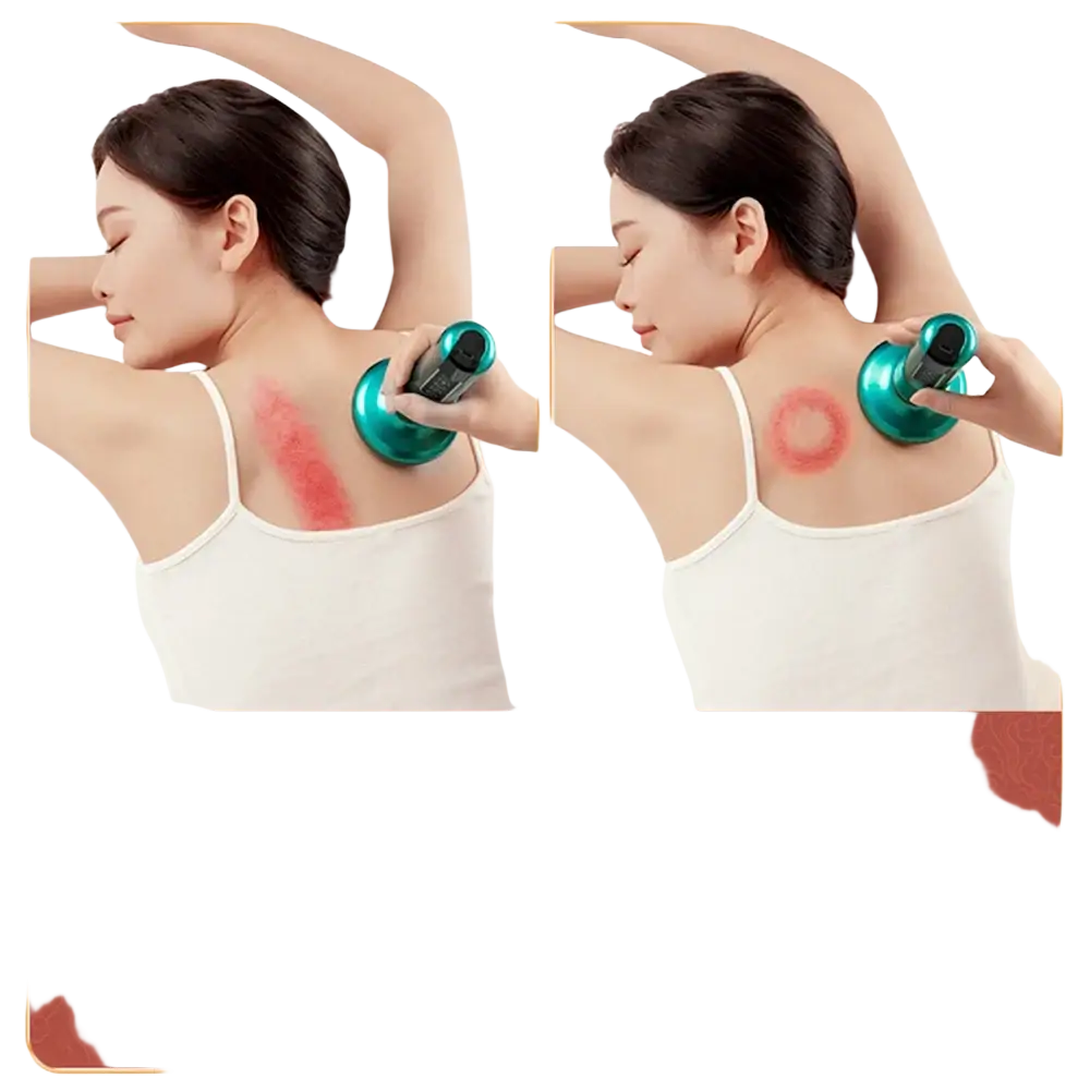 Appareil de Massage électrique multifonctionnel méridien Guasha grattage masseur canettes sous vide brûleur de graisse