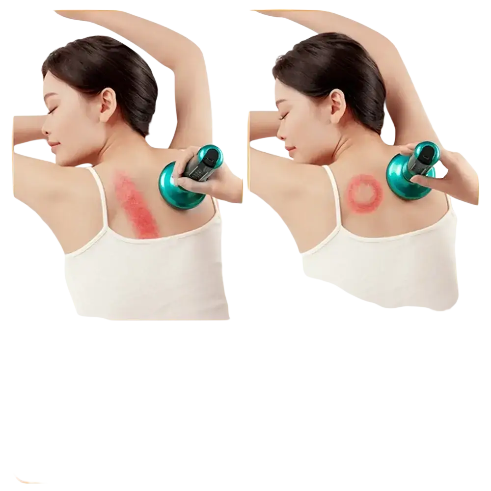 Appareil de Massage électrique multifonctionnel méridien Guasha grattage masseur canettes sous vide brûleur de graisse