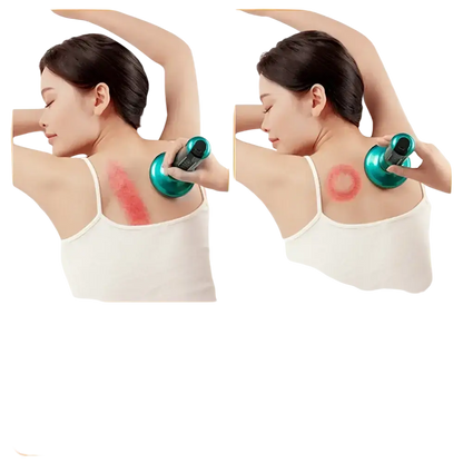 Appareil de Massage électrique multifonctionnel méridien Guasha grattage masseur canettes sous vide brûleur de graisse
