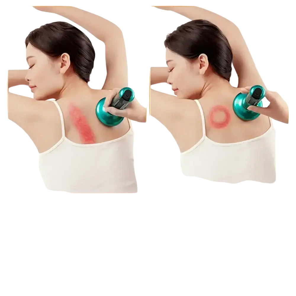 Appareil de Massage électrique multifonctionnel méridien Guasha grattage masseur canettes sous vide brûleur de graisse