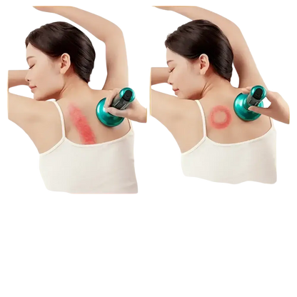 Appareil de Massage électrique multifonctionnel méridien Guasha grattage masseur canettes sous vide brûleur de graisse