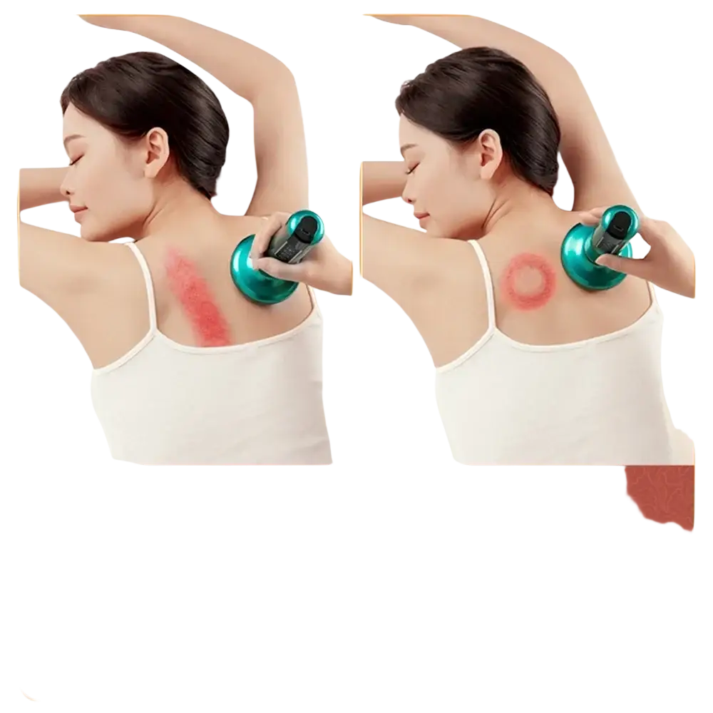 Appareil de Massage électrique multifonctionnel méridien Guasha grattage masseur canettes sous vide brûleur de graisse